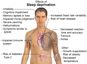 Photo of what happens with sleep deprivision.