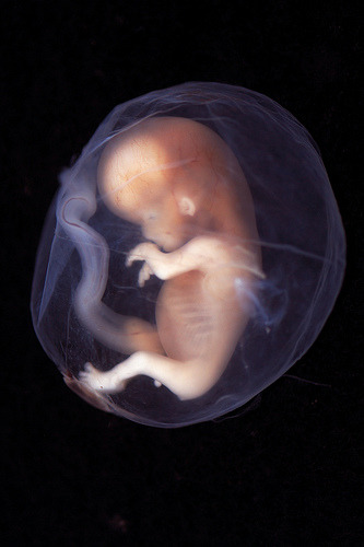 fetus fetus