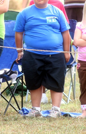 child_obesity Close-up of the belly of an obese child.