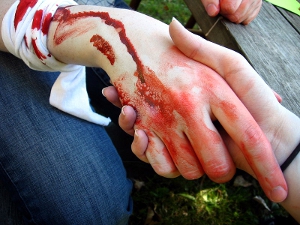A bloody handshake.